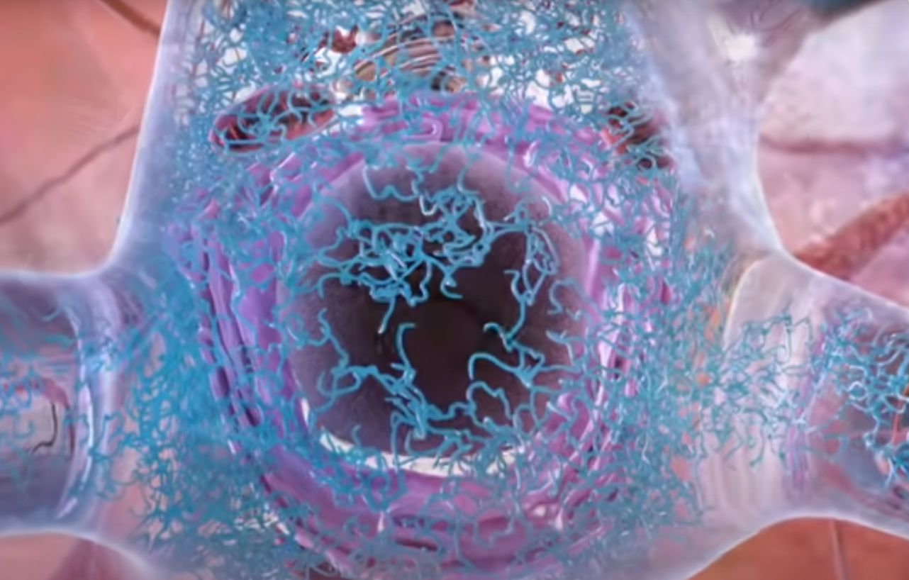 Tau tangle proteins in the brain